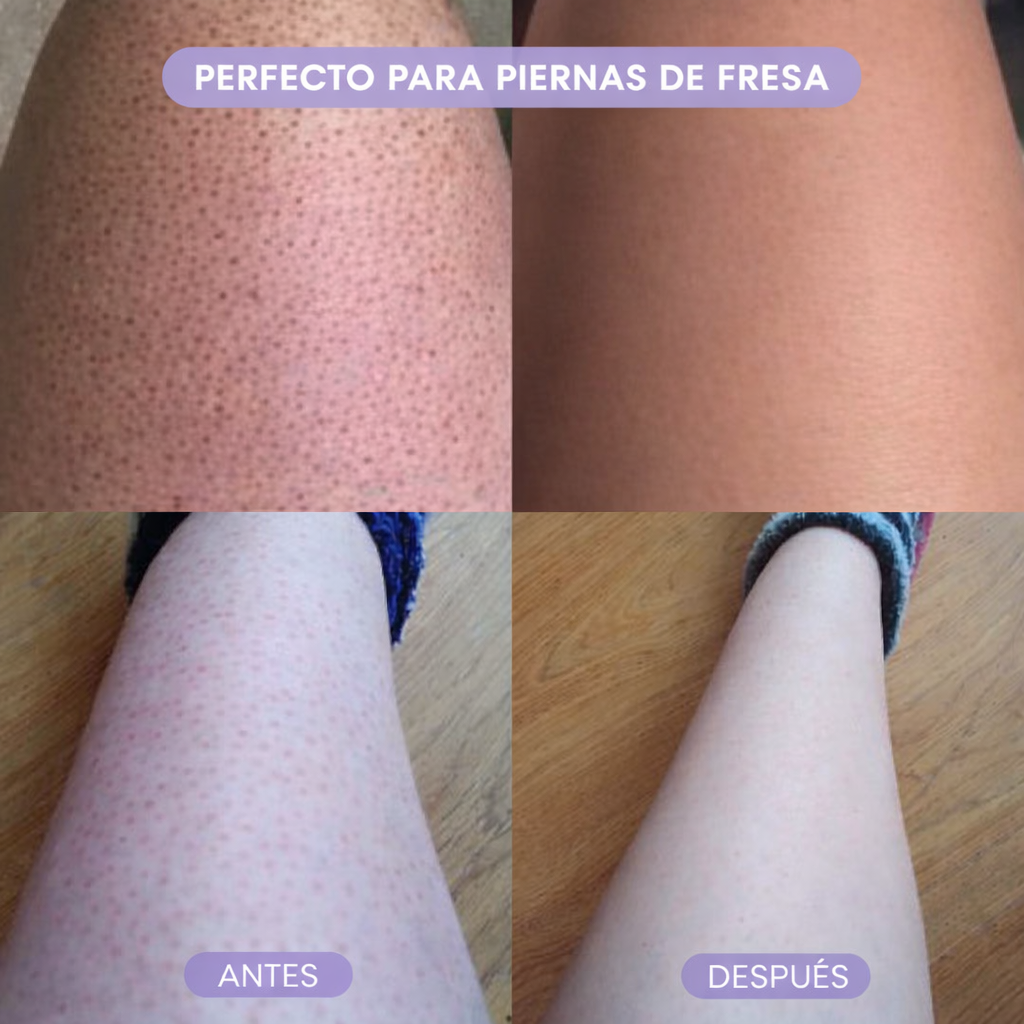 Depiladora Glem Crystal
